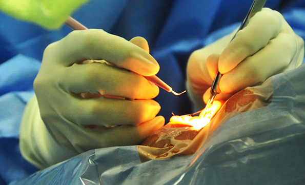 白内障手術のイメージ