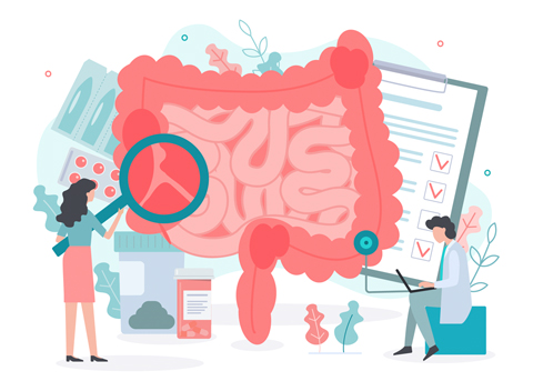 大腸内視鏡検査のイメージ