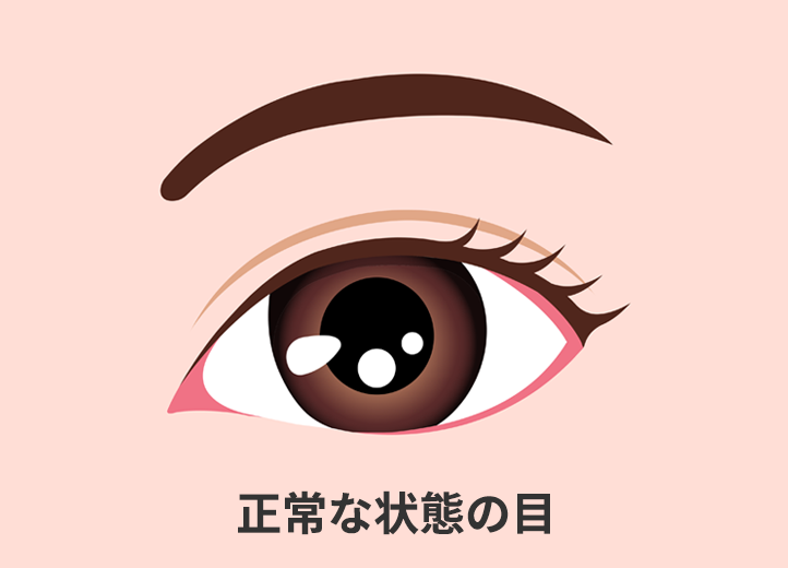 正常な状態の目